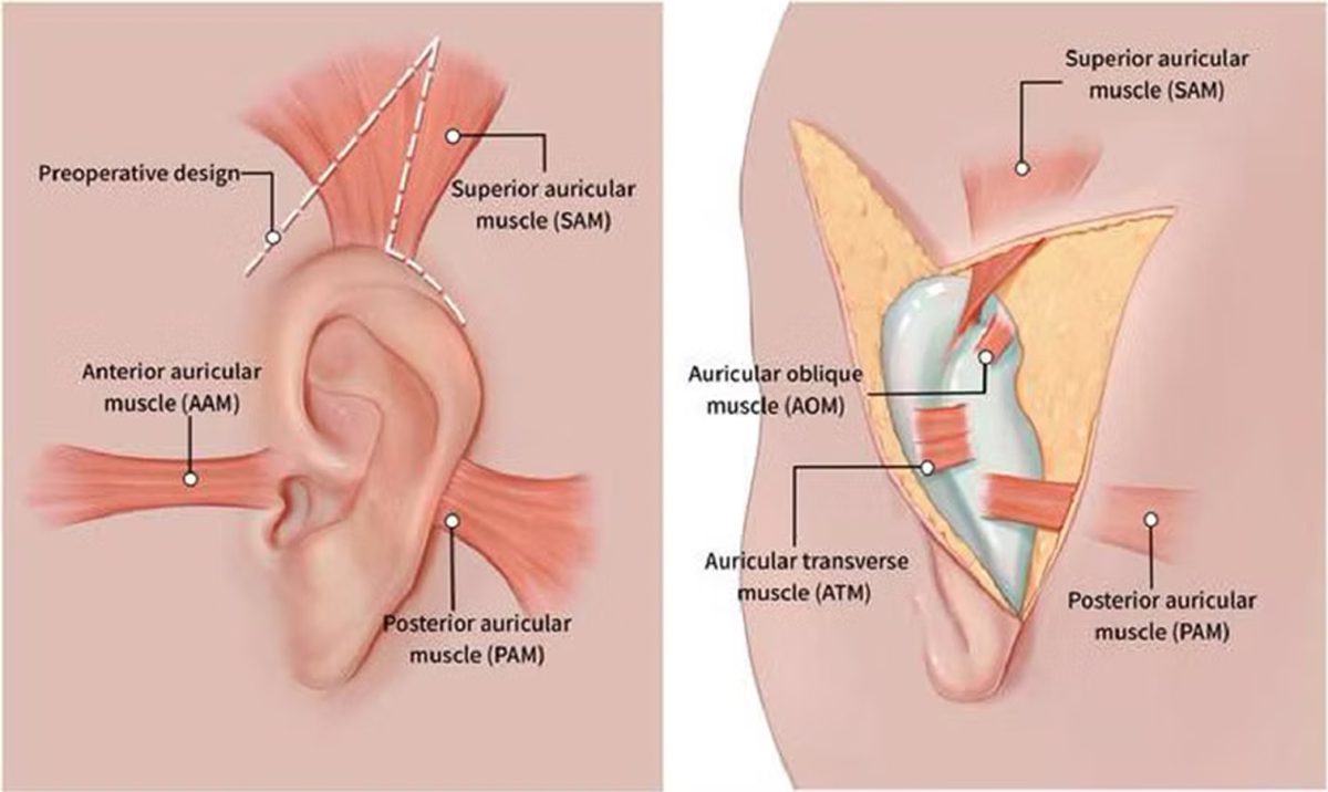 Co způsobuje kryptocii?