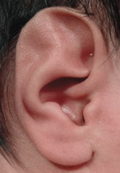 Stahlovo ucho - EarWell